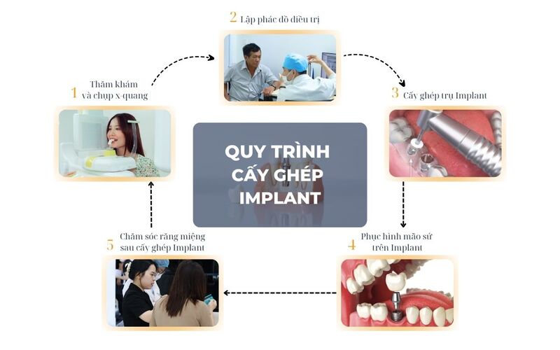 Quy Trình Chuẩn Y Khoa Tại Nha Khoa Kim Xuân