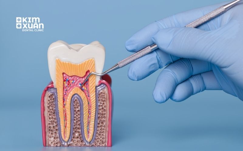 Răng Chết Tủy Diễn Ra Như Thế Nào