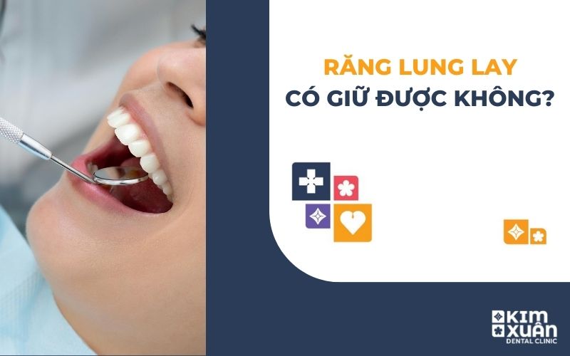 Răng Lung Lay Có Giữ Được Không