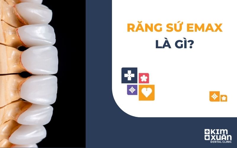 Răng Sứ Emax