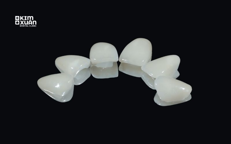 Răng Sứ Emax Giá Bao Nhiêu Tiền