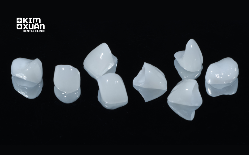 Răng Sứ Thẩm Mỹ Tại Nha Khoa Kim Xuân