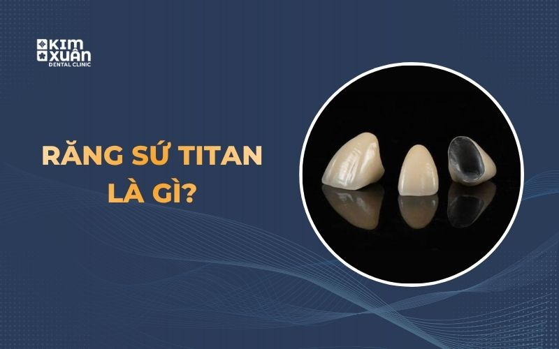 Răng sứ titan