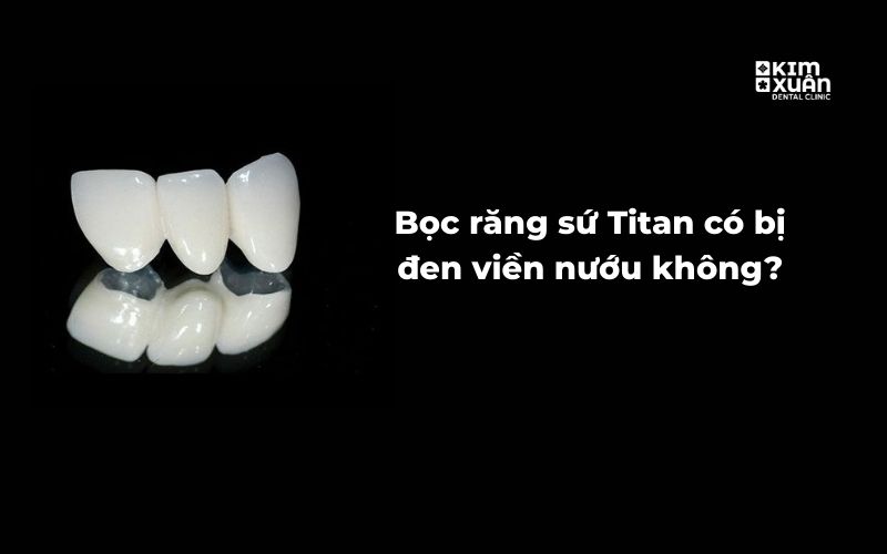 Răng Sứ Titan Có Đen Viên Nướu Không