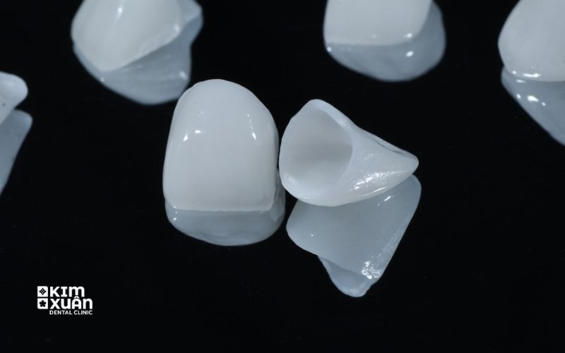 Răng Sứ Zirconia Có Tốt Không
