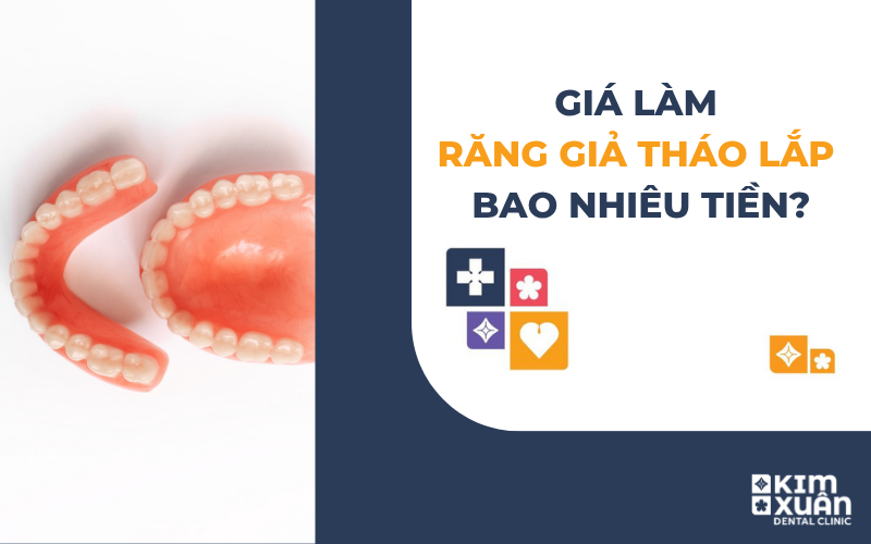 Răng Tháo Lắp Giá Bao Nhiêu Tiền