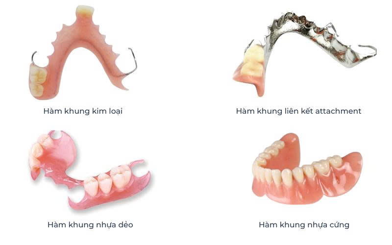 Răng Tháo Lắp Toàn Hàm Giá Bao Nhiêu