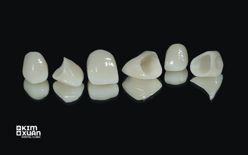 Răng Toàn Sứ Cercon HT