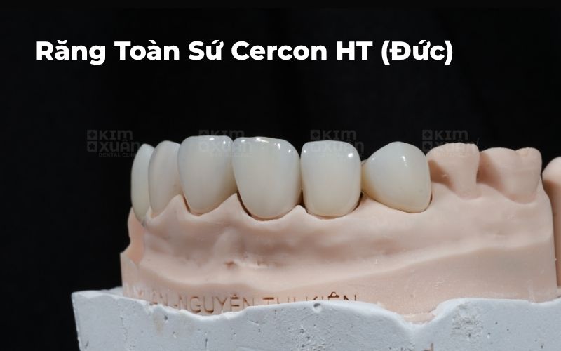 Răng Toàn Sứ Cercon HT Đức