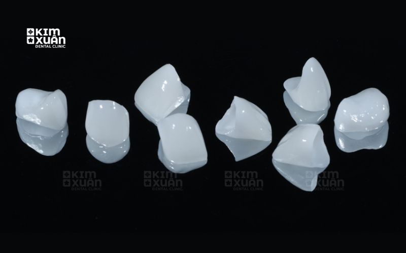 Răng Toàn Sứ Có Tốt Không