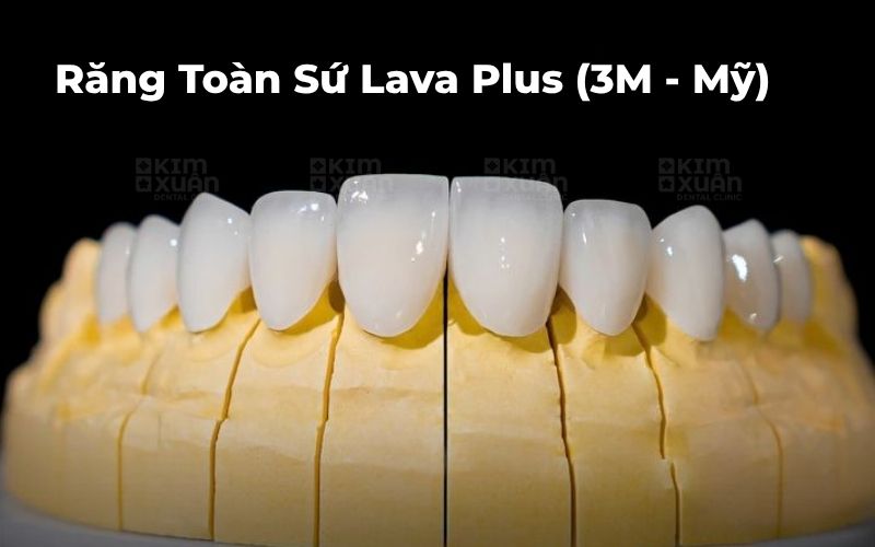 Răng Toàn Sứ Lava Plus