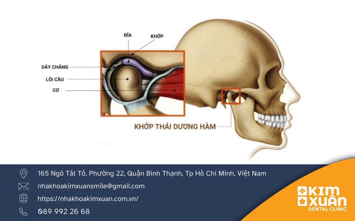 Rối Loạn Khớp Thái Xương Hàm