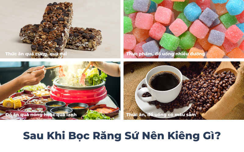 Sau Khi Bọc Răng Sứ Nên Kiêng Gì?