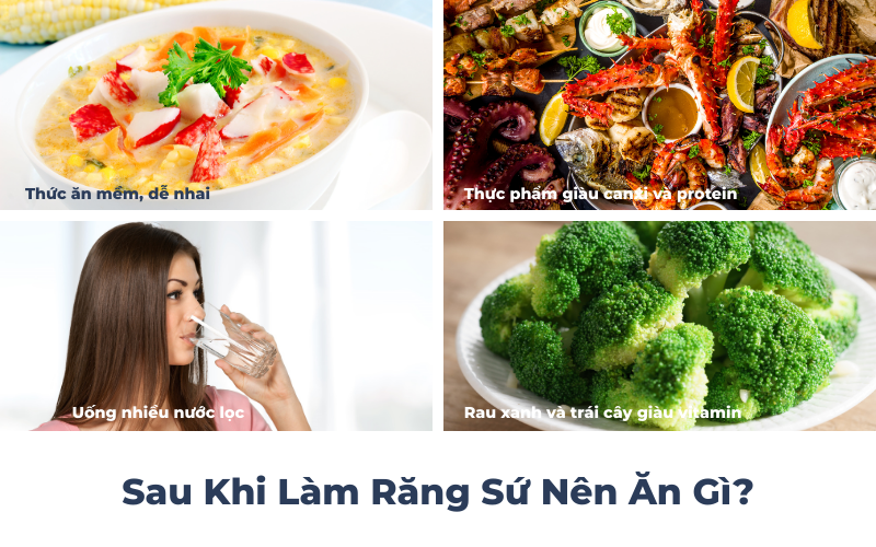 Sau Khi Làm Răng Sứ Nên Ăn Những Gì?