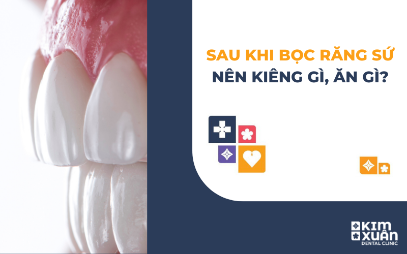 Sau Khi Làm Răng Sứ Nên Kiêng Gì