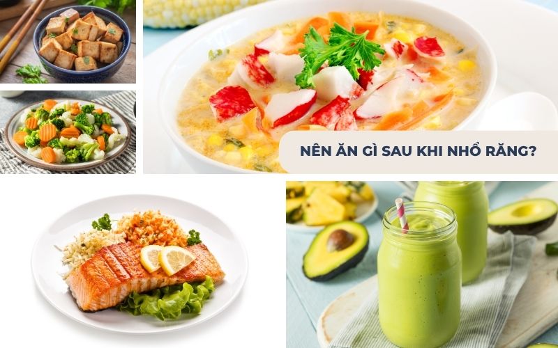 Sau Khi Nhổ Răng Nên Ăn Gì