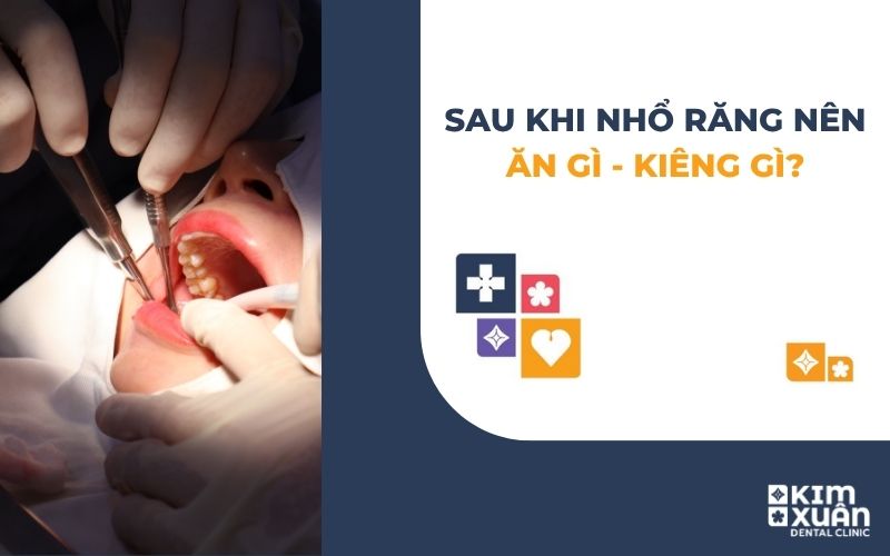 Sau Khi Nhổ Răng Nên Ăn Gì Kiêng Gì