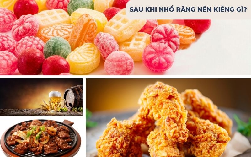 Sau Khi Nhổ Răng Nên Kiêng Gì