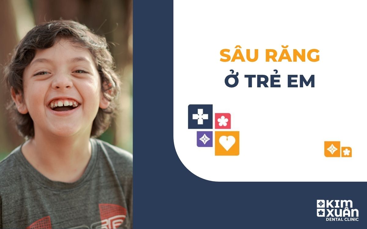 Sâu Răng Ở Trẻ Em
