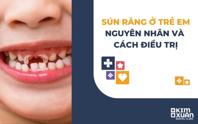Sún Răng Ở Trẻ Em