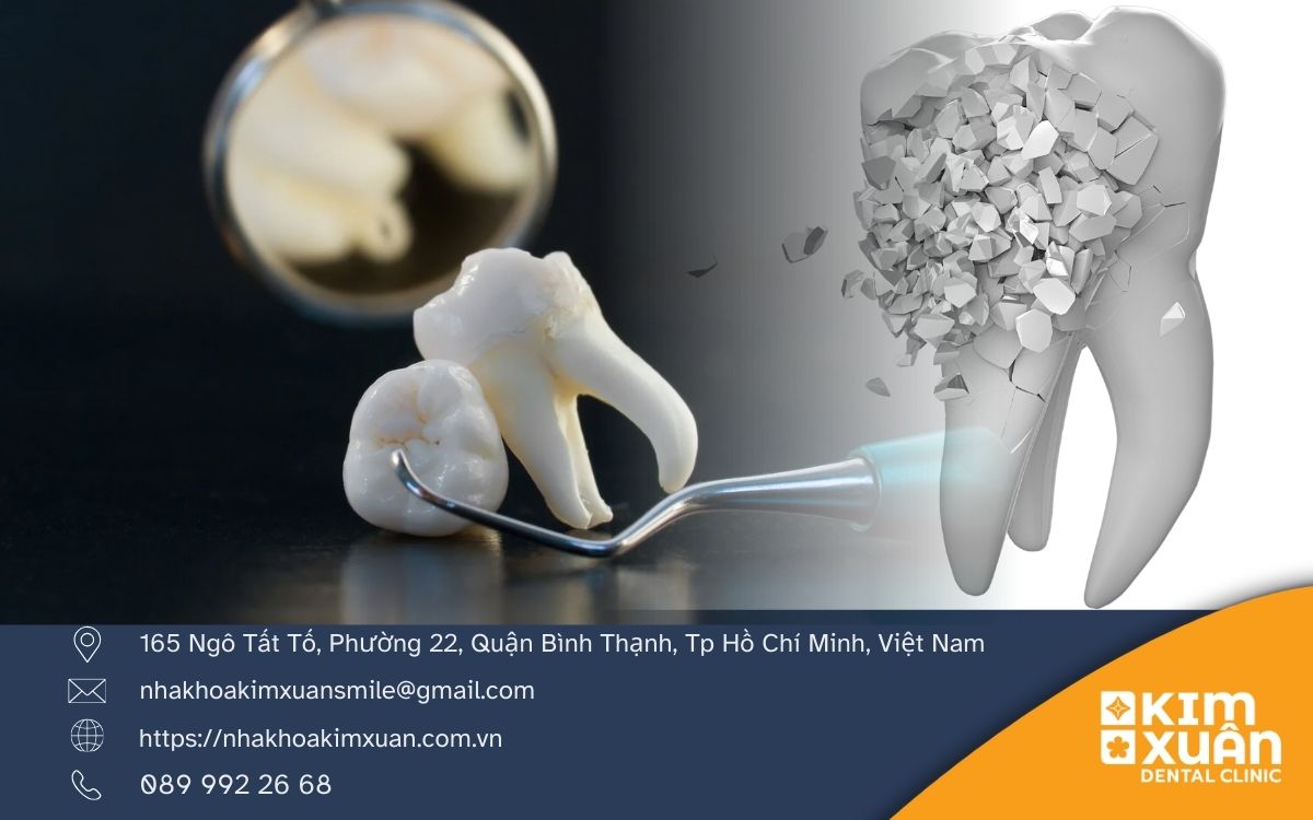 Tác Hại Của Răng Khôn Mọc Lệch