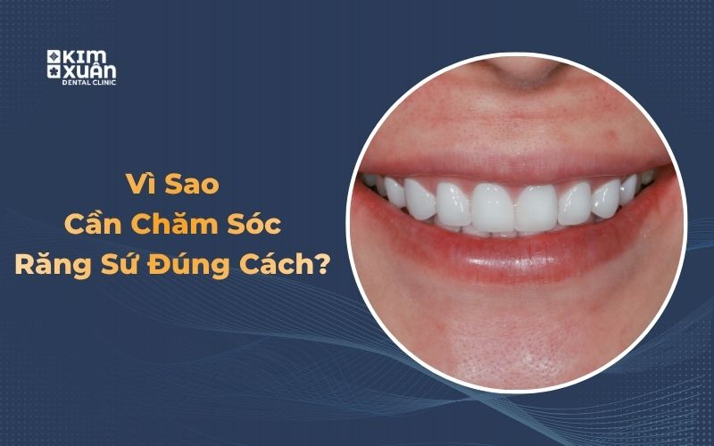 Tại sao cần chăm sóc răng sứ đúng cách