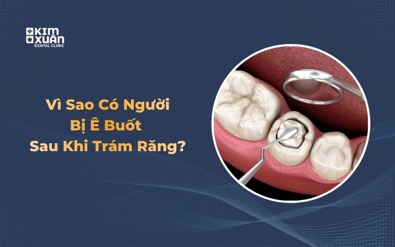 Tại sao sau khi trám răng thì bị ê buốt