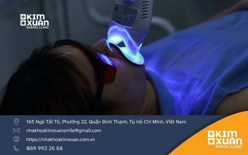 Tẩy Trắng Răng Bao Lâu Thì Làm Lại