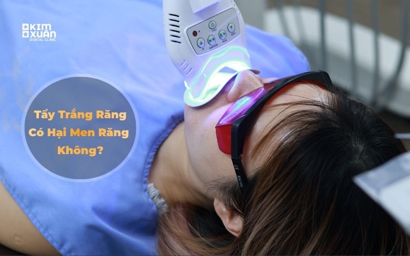 Tẩy trắng răng có hại men răng không
