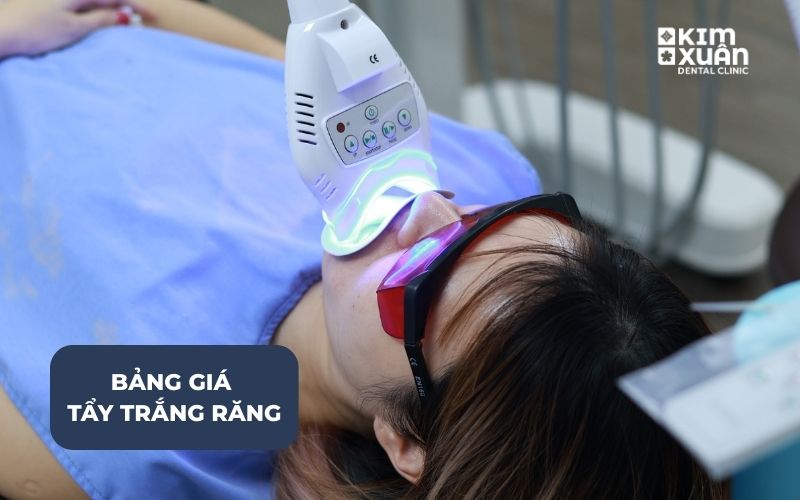 Tẩy Trắng Răng Giá Bao Nhiêu Tiền