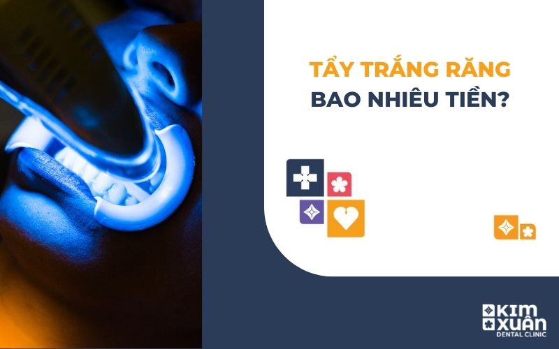 Tẩy Trắng Răng Giá Bao Nhiêu Tiền Tại TP. HCM