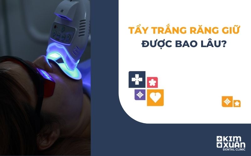 Tẩy Trắng Răng Giữ Được Bao Lâu