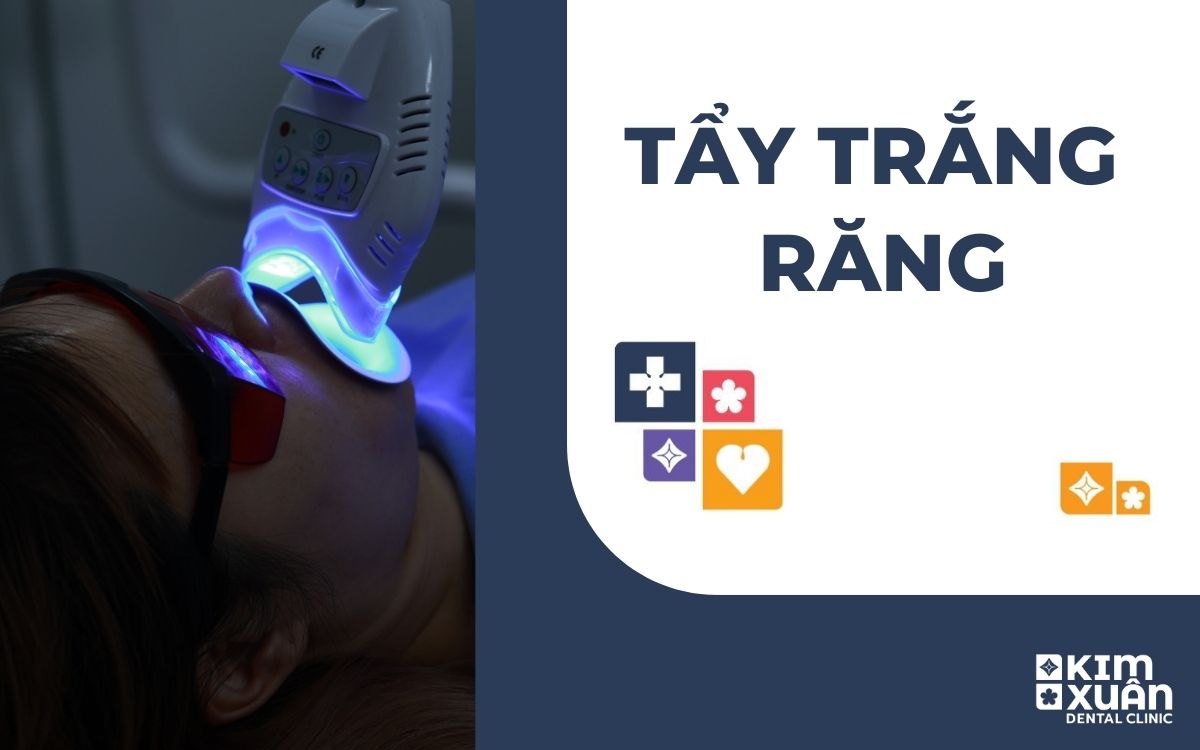 Tẩy Trắng Răng 