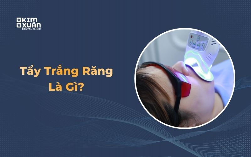 Tẩy trắng răng 