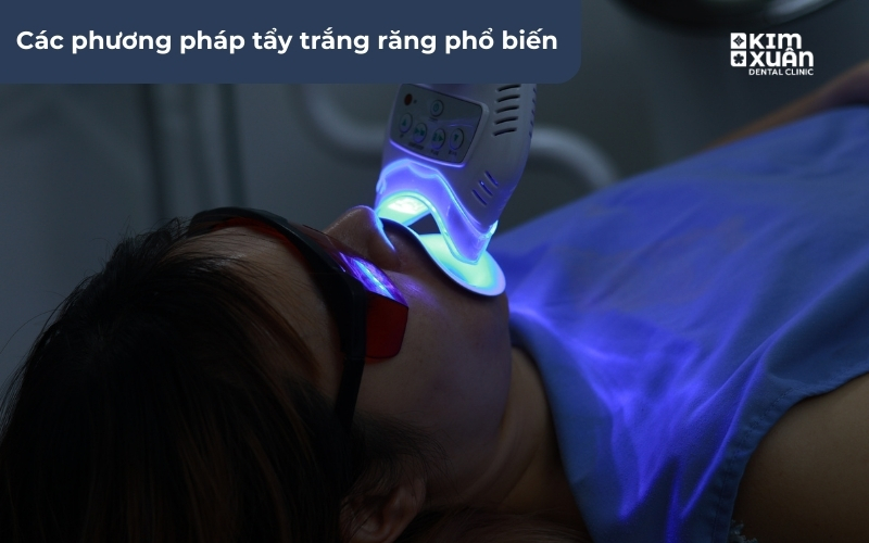 Tẩy Trắng Răng Tại Phòng Khám