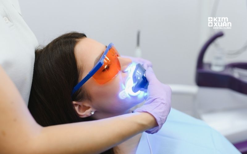 Tẩy Trắng Răng Tại Phòng Khám