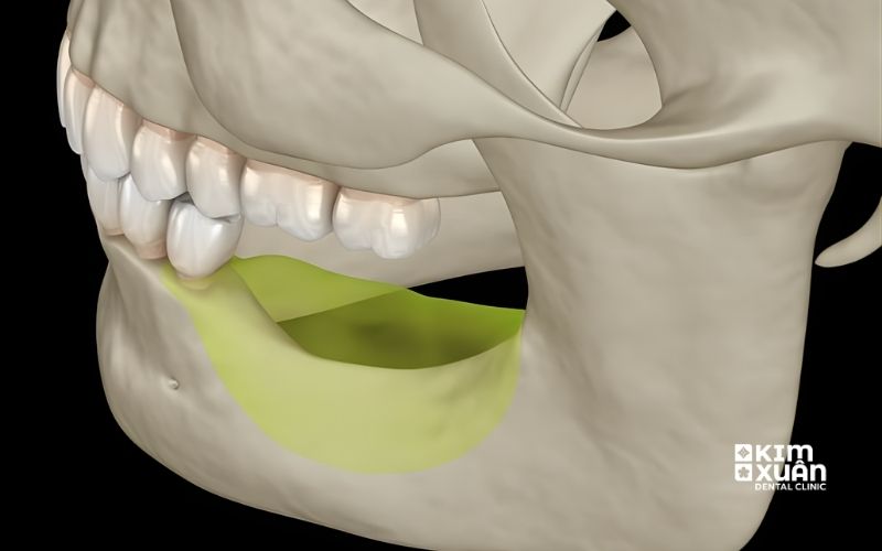 Tiêu Xương Hàm Có Nguy Hiểm Không