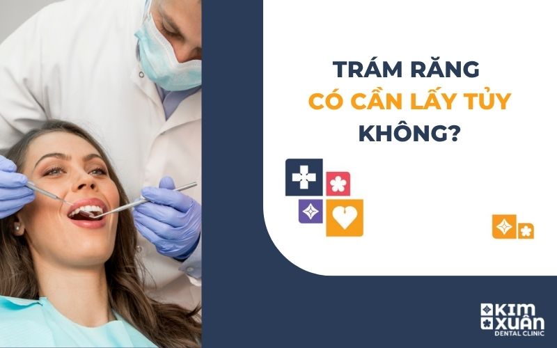 Trám Răng Có Cần Lấy Tủy Không?