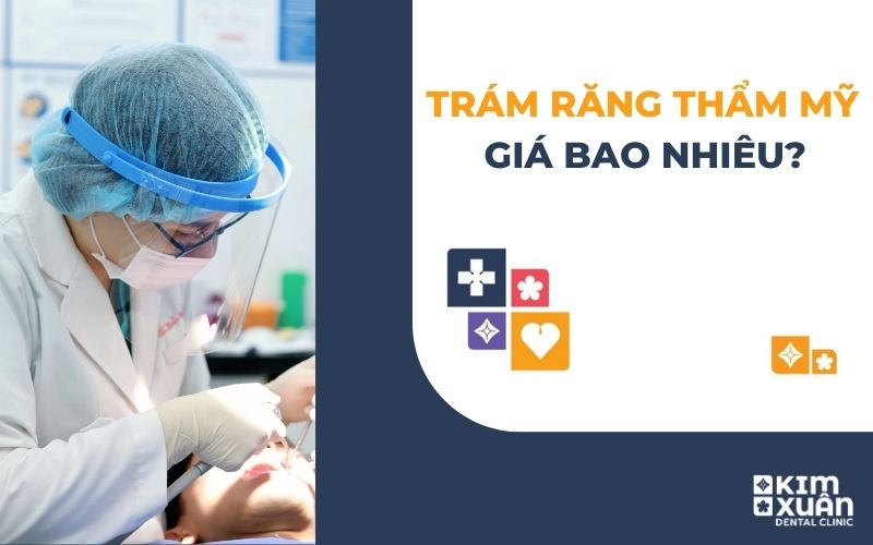 Trám Răng Thẩm Mỹ Giá Bao Nhiêu