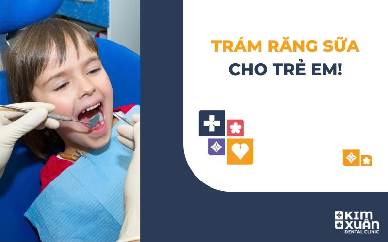 Trám Răng Sữa Cho Trẻ Em