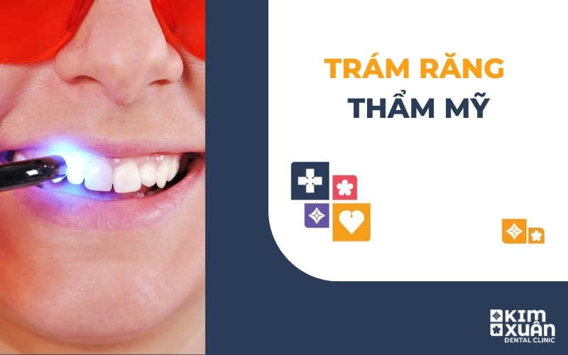 Trám Răng Thẩm Mỹ