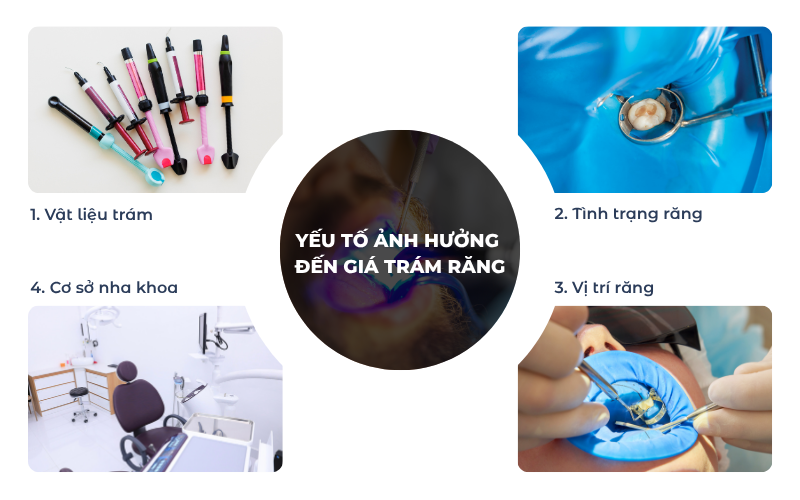 Trám Răng Thẩm Mỹ Giá Bao Nhiêu