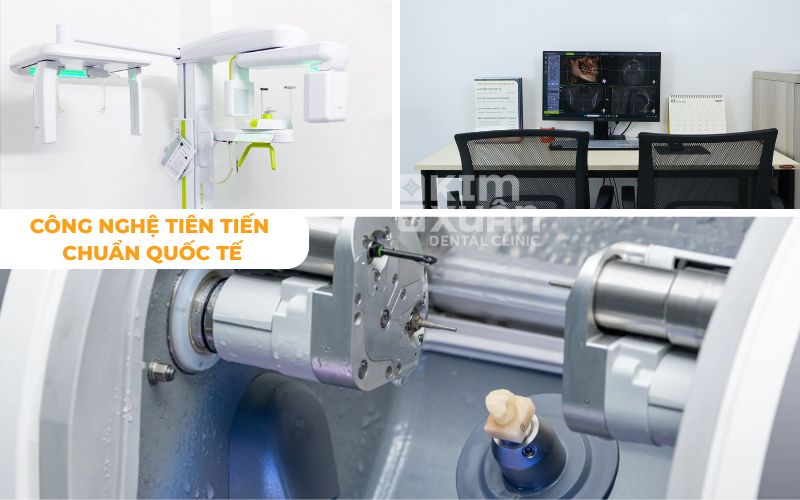 Trang Thiết Bị Hiện Đại Tại Nha Khoa Kim Xuân