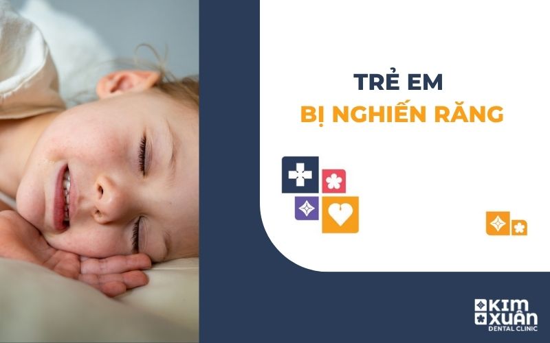 Trẻ Em Bị Nghiến Răng Nguyên Nhân Và Cách Điều Trị