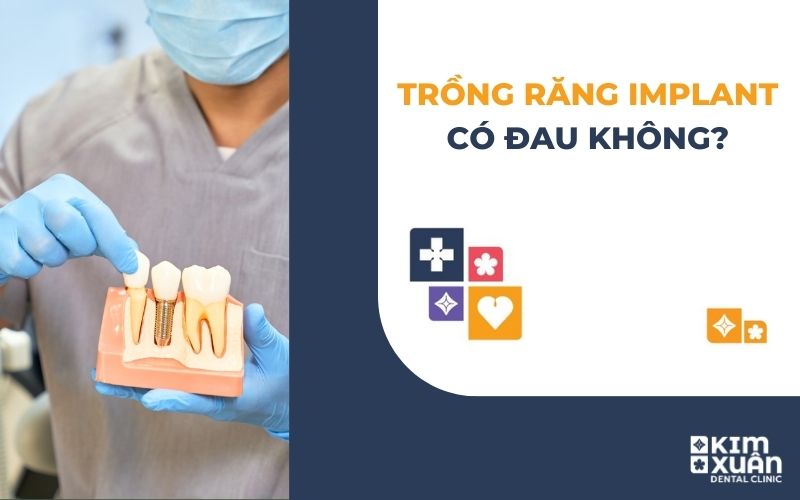 Trồng Răng Implant Có Đau Không
