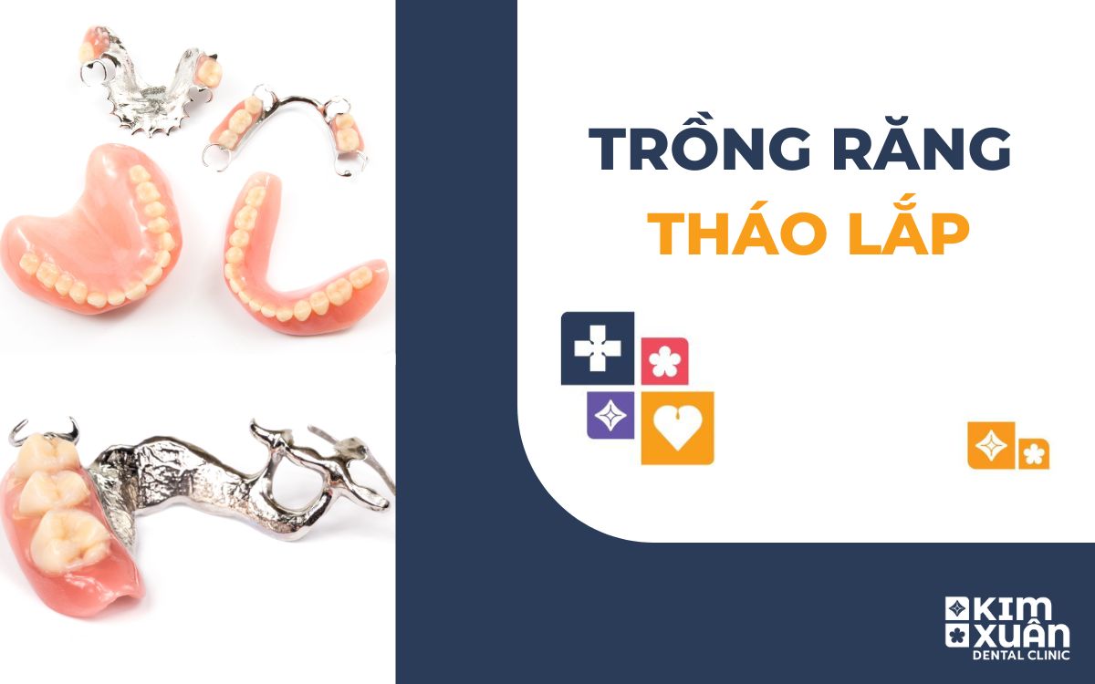 Trồng Răng Tháo Lắp