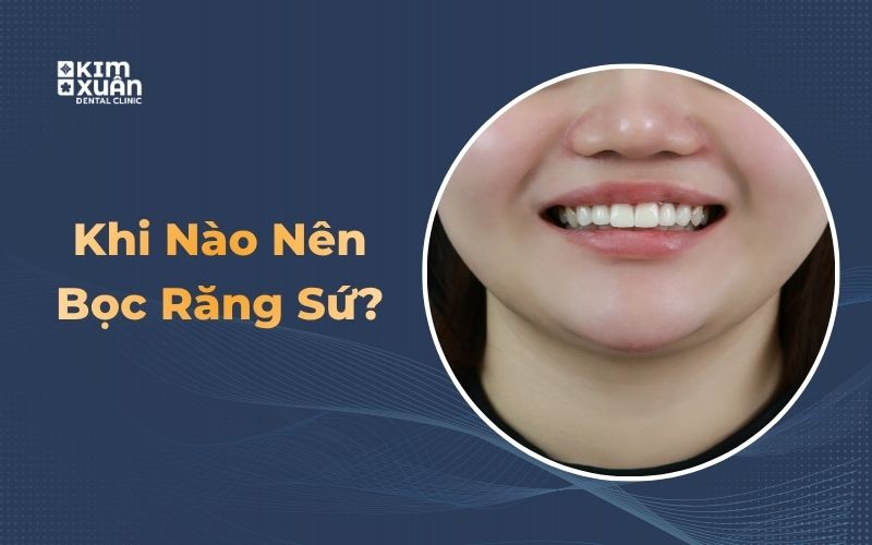 Trường Hợp Nên Bọc Răng Sứ