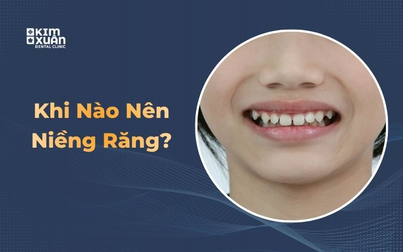 Trường Hợp Nên Niềng Răng