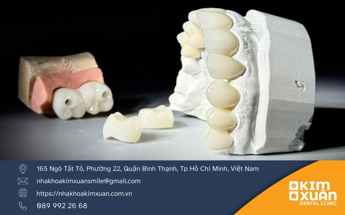 Ưu Điểm Của Răng Sứ Cercon HT