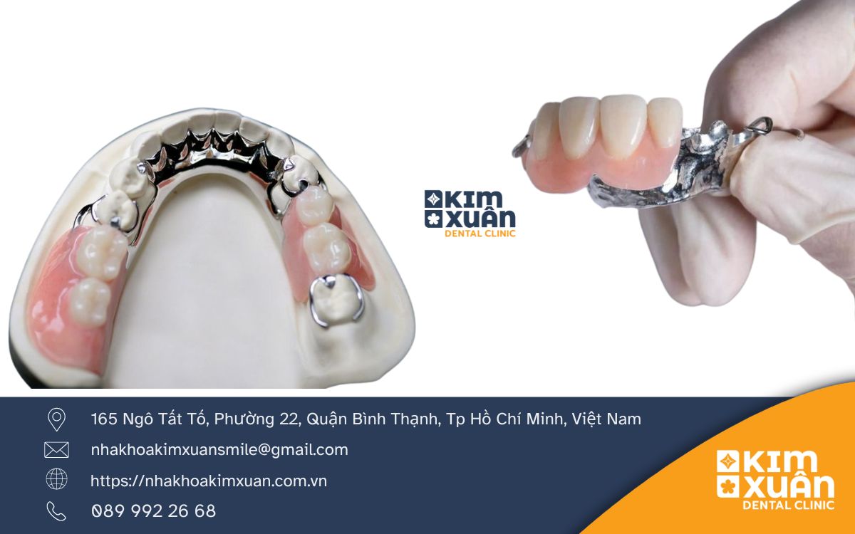 Ưu Điểm Của Trồng Răng Tháo Lắp